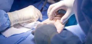 الدليل الشامل لعملية تثبيت مفصل اليد في مصر