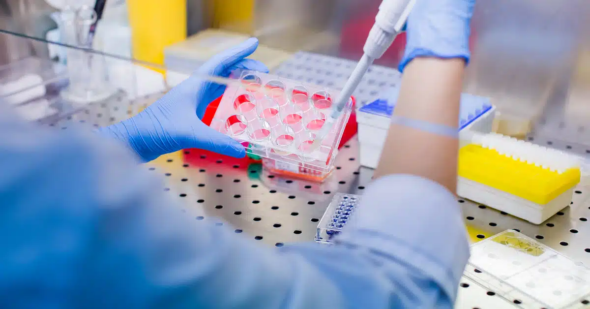 تكلفة حقن الخلايا الجذعية في مصر