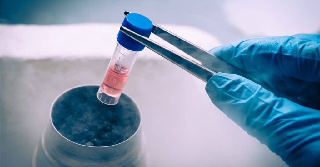 حقن الخلايا الجذعية: الدليل الكامل للعلاج والتكلفة والنتائج