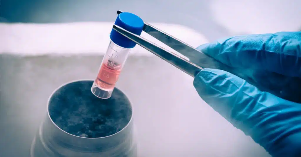 حقن الخلايا الجذعية: الدليل الكامل للعلاج والتكلفة والنتائج