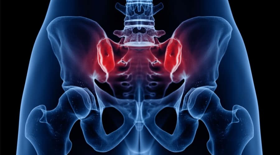 التهاب مفصل الحوض