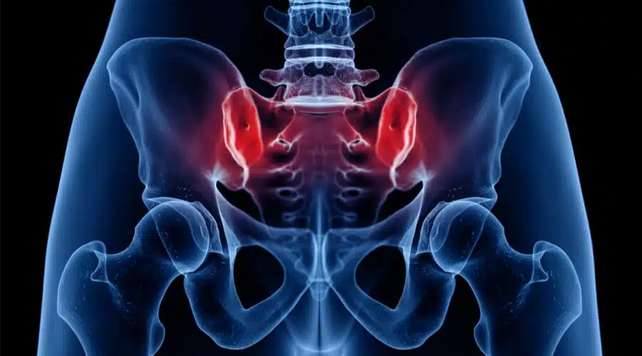 دليلك الشامل لعلاج التهاب مفصل الحوض