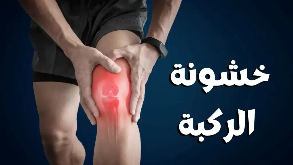 أفضل 10 أنواع دهانات ومراهم لعلاج خشونة الركبة