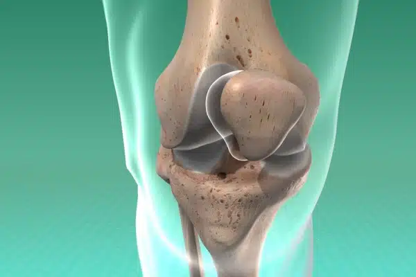 خلع صابونة الركبة المتكرر: الأسباب والعلاج